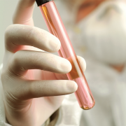 TERMOREAKTÖR (NTC-01)